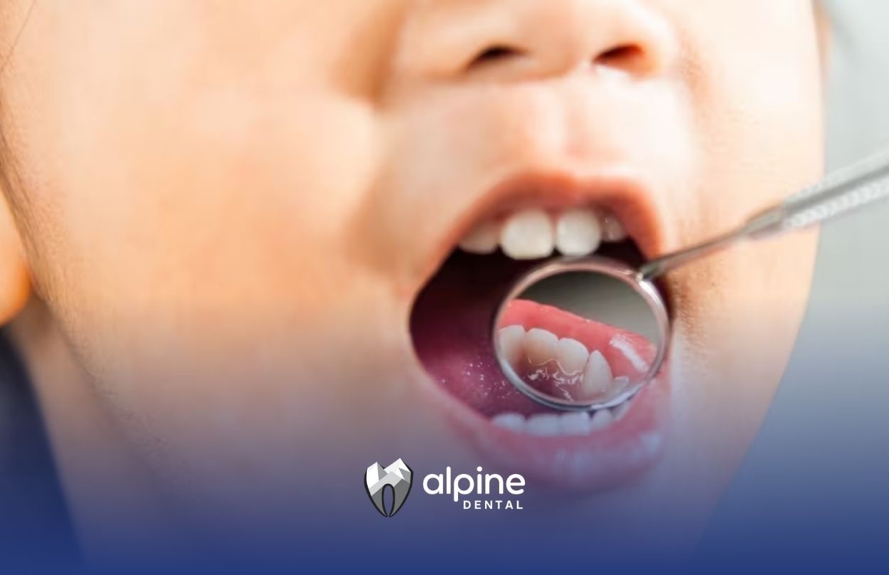 Are Oral Health Issues Genetic?