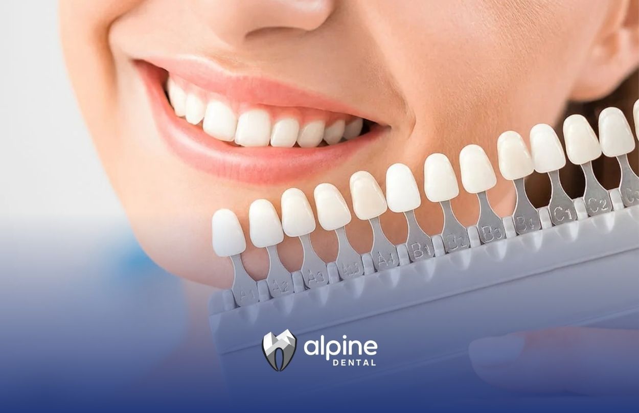 How Dental Crowns and Bridges Can Restore Smiles Effectively