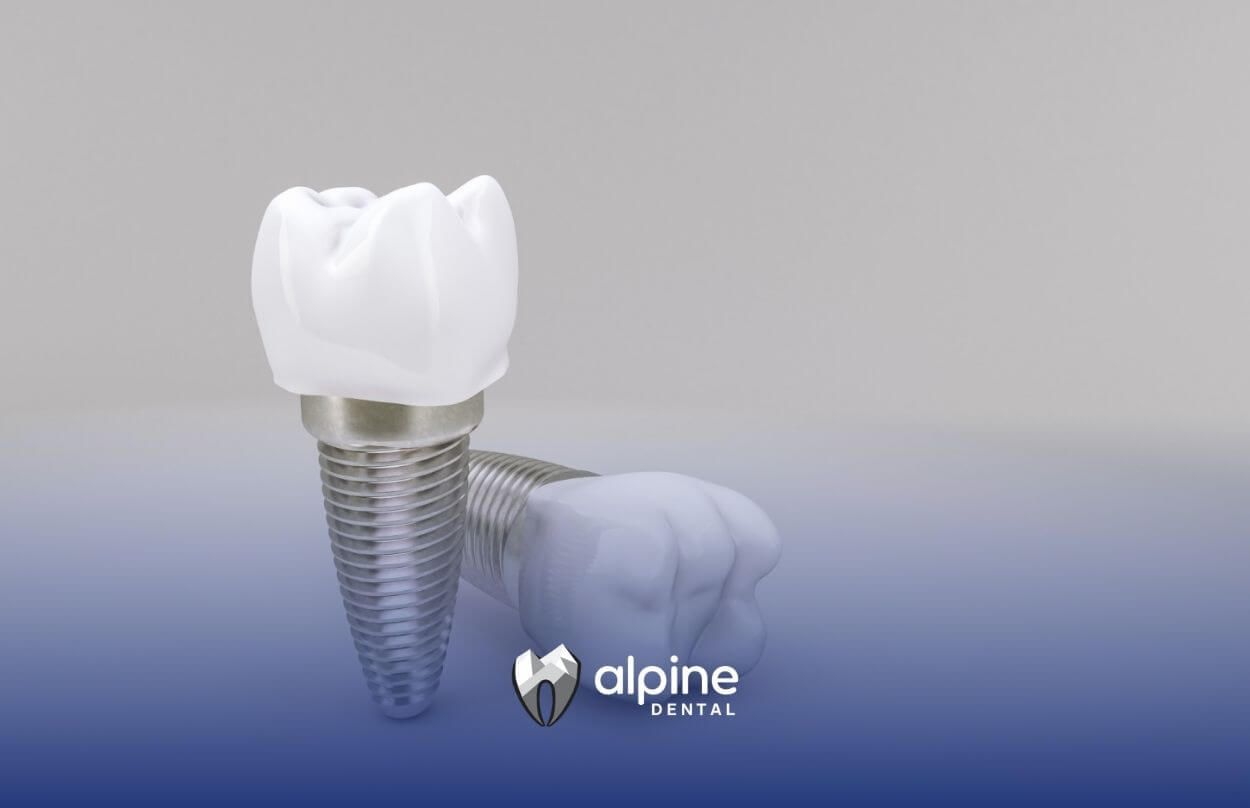 Dental Implant Failure: The Real Reasons Nobody Talks About