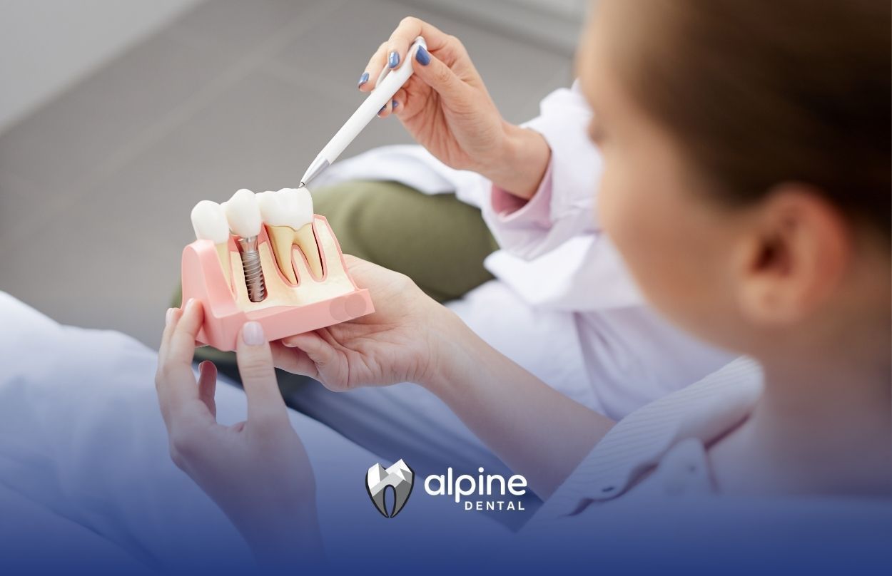 The Dental Implant Process: A Comprehensive Guide