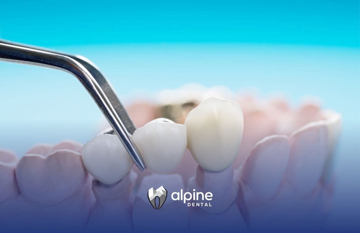 Crown Lengthening: Pain, Healing & What to Expect Post-Surgery