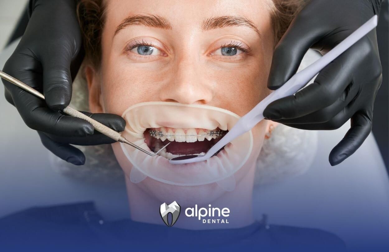 How to Stop Gagging at the Dentist