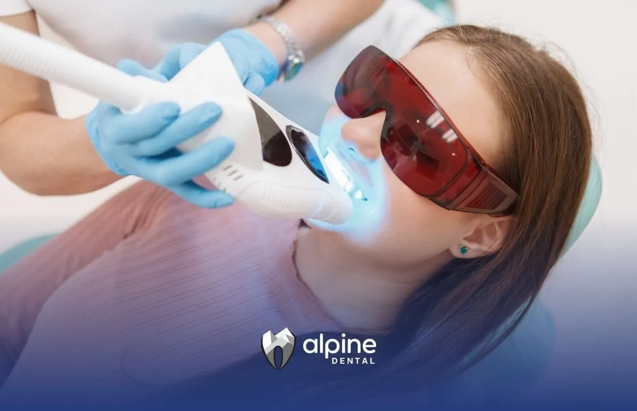 Is Whitening Teeth Every Year OK? Safety Tips & Dentist Advice