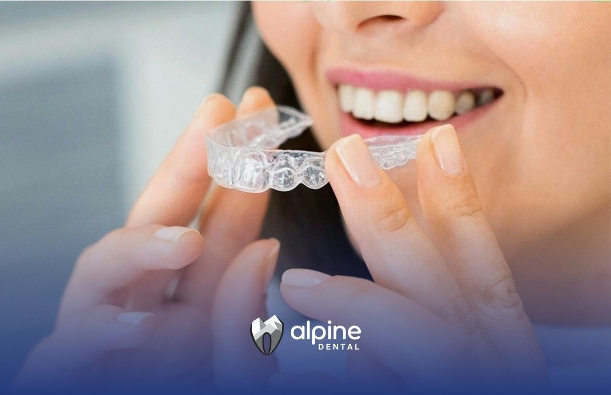 Is Clear Aligner Faster Than Braces?