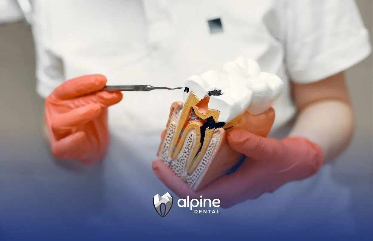 Is It Cheaper to Pull a Tooth or Root Canal?