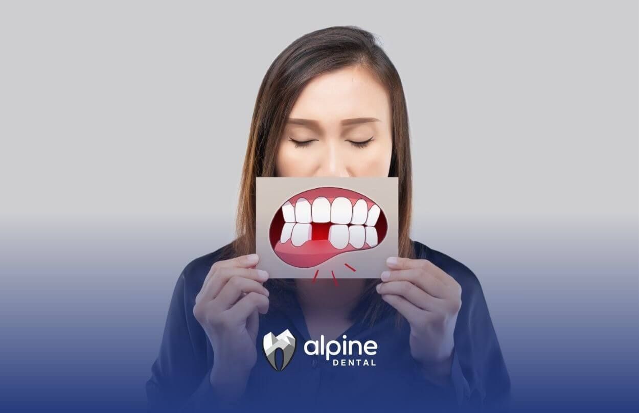 Soothe Swollen Gums with These Powerful Treatment Methods
