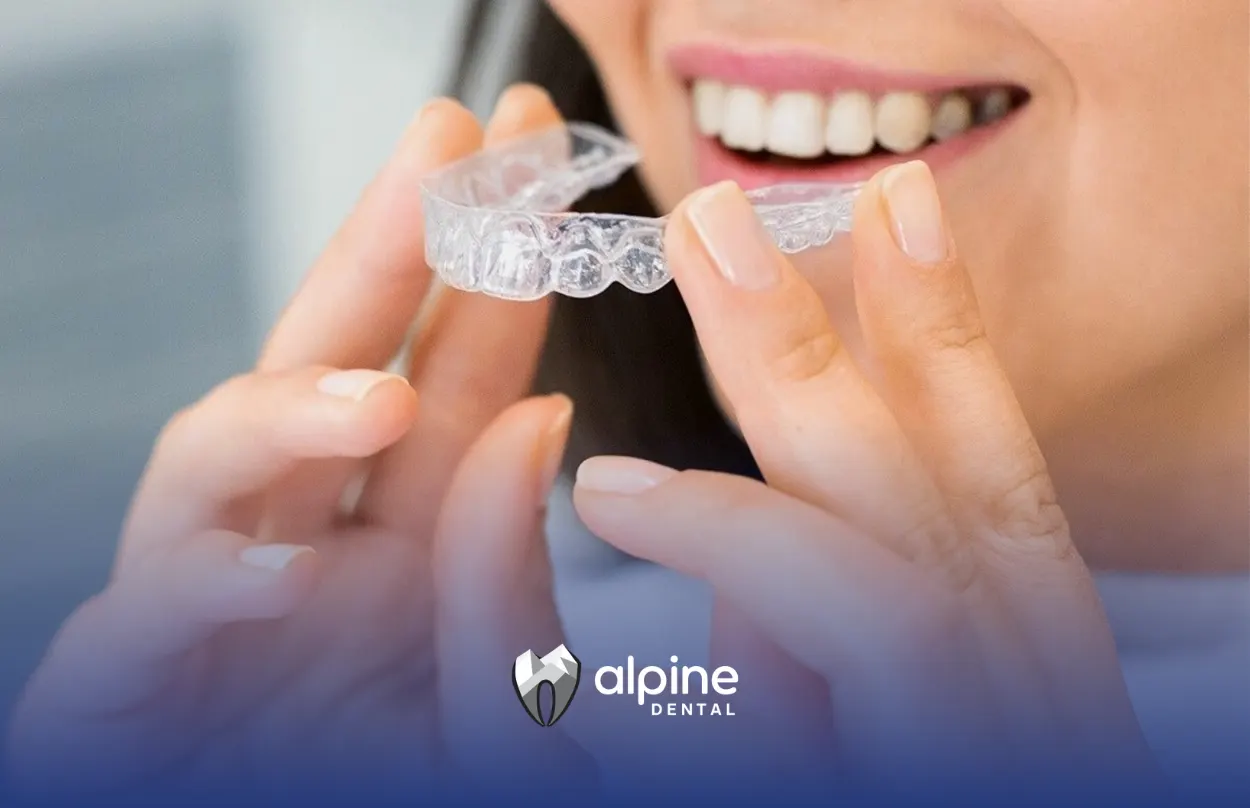 What Are Emax Veneers? Review of Features and Cost