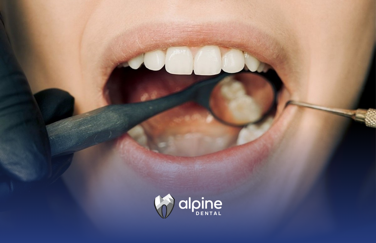 What Are the Symptoms of Sepsis in the Teeth?