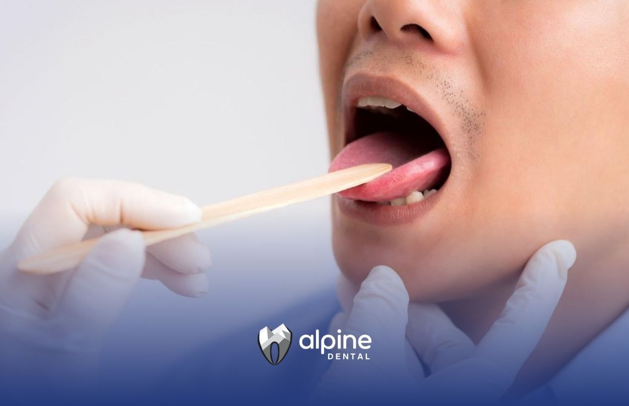 What Are Five Oral Health Diseases?