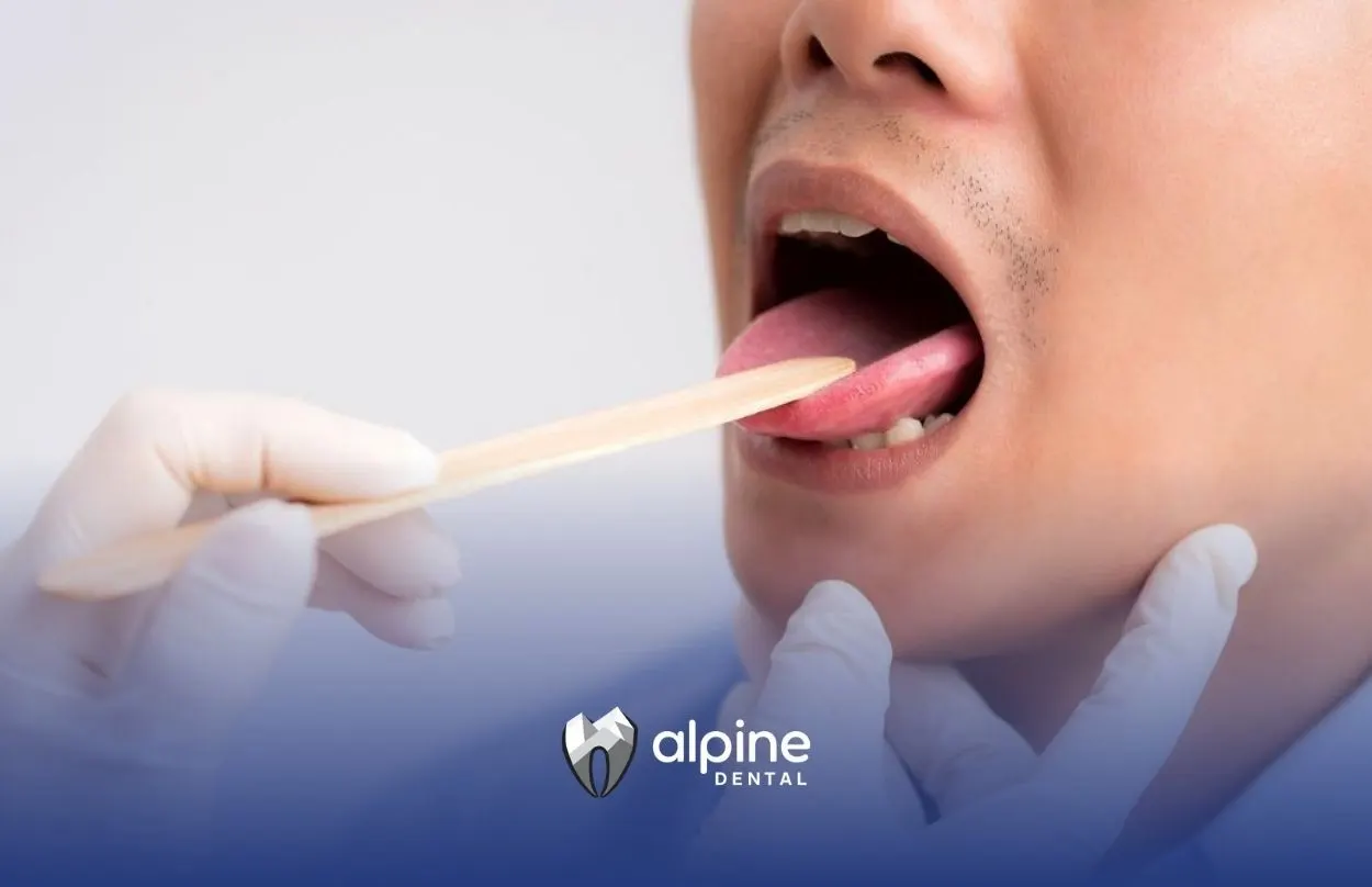 What Are Five Oral Health Diseases?