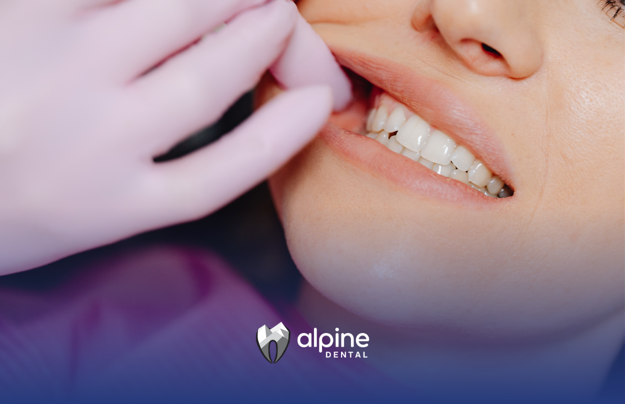 Why Is My Cracked Tooth Not Hurting?