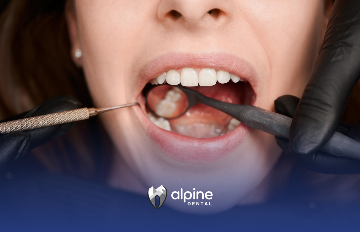 How to Fix an Extra Tooth? A Complete Guide to Supernumerary Teeth