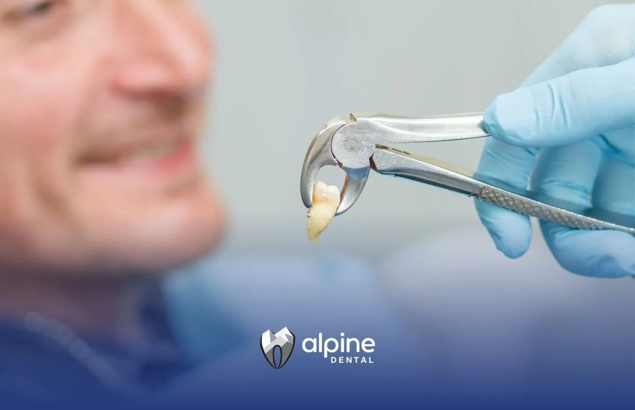 How Much Is a Tooth Extraction Without Insurance in NJ? Here’s What to Expect