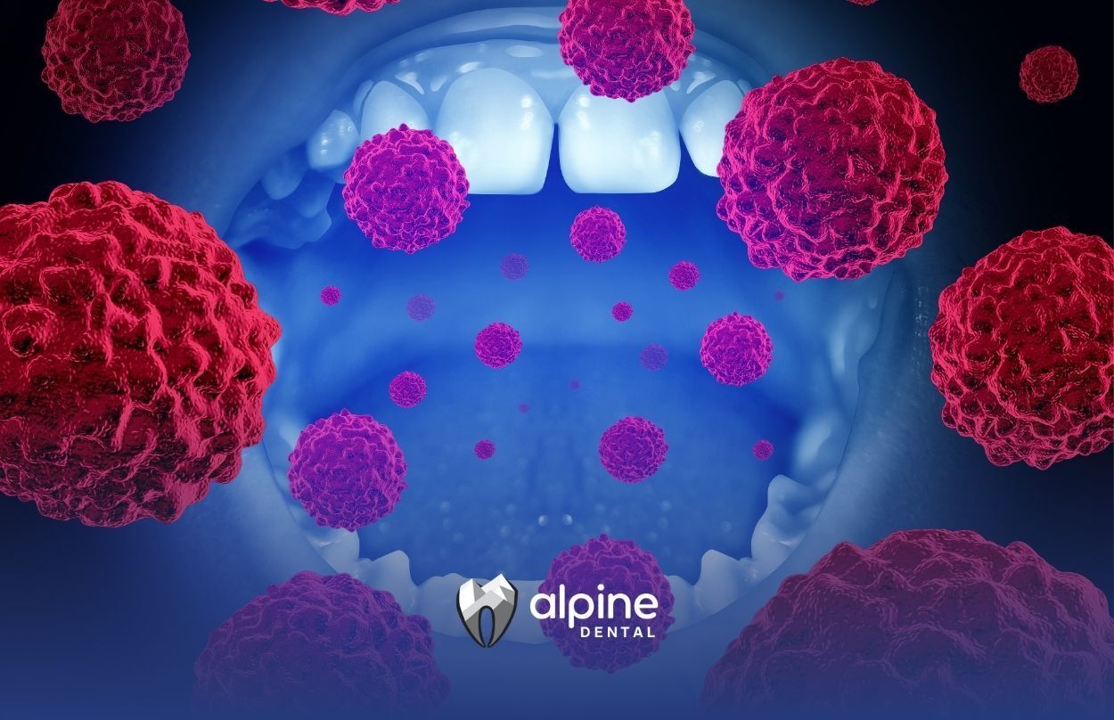 What Is the Main Cause of Oral Cancer? Risks, Symptoms & Prevention Explained