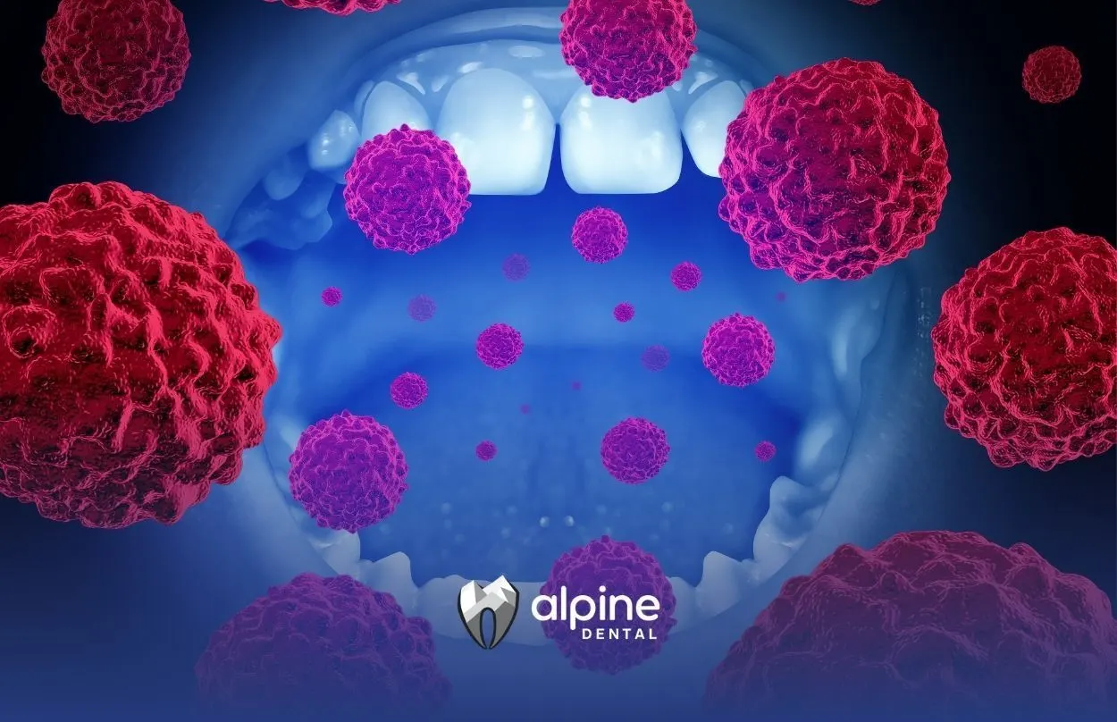 What Is the Main Cause of Oral Cancer? Risks, Symptoms & Prevention Explained