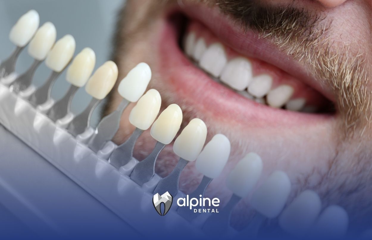 Porcelain Veneers Near Me: Benefits, Procedure, and Care Tips