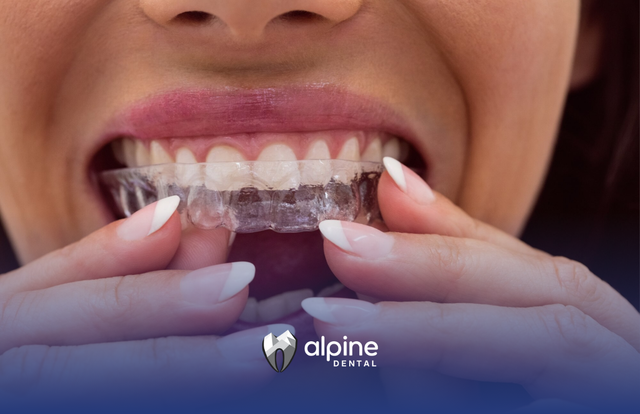 Signs You're a Good Candidate for Invisalign
