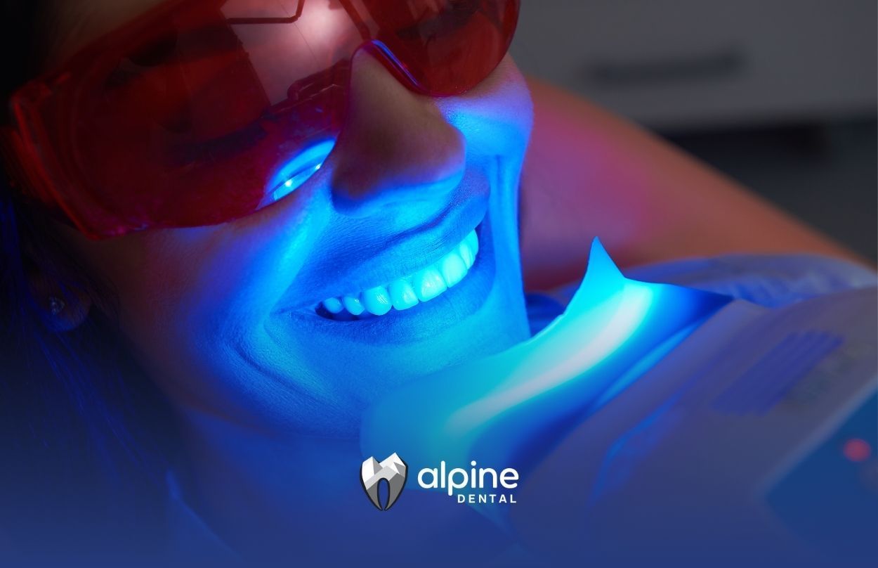 How Does Teeth Whitening Work? Dentist vs. At-Home, Costs, and Results Explained