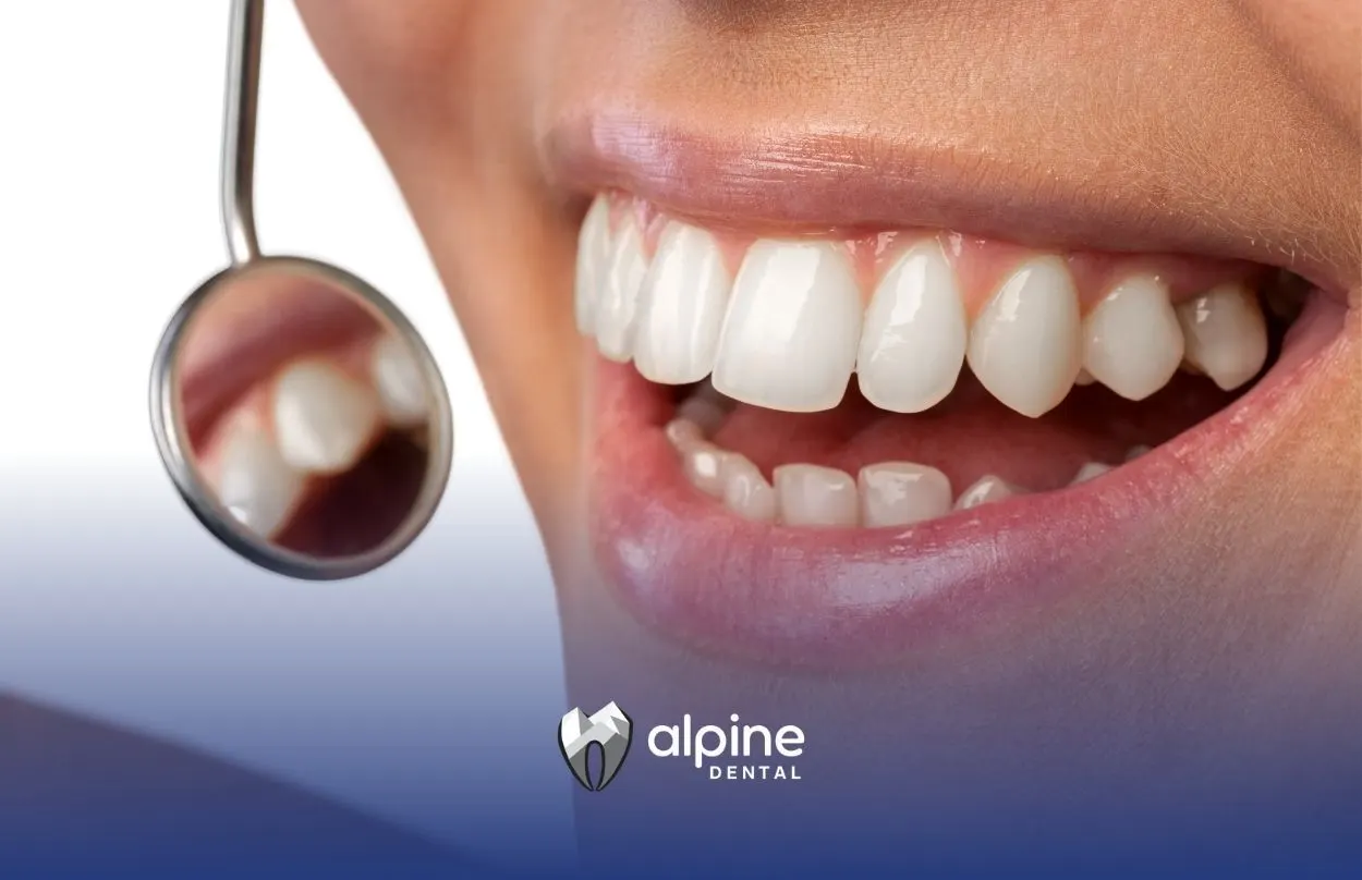 What Is Tooth Enamel? A Complete Guide to Protecting Your Smile