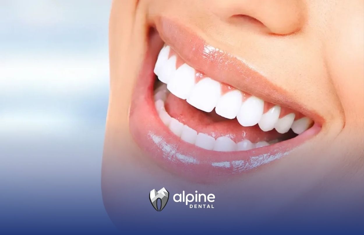 Affordable Options for Achieving a Hollywood Smile