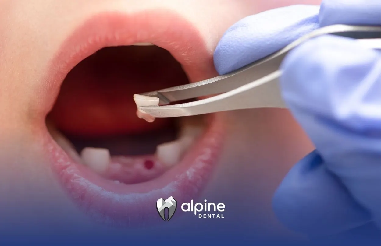 What Does Tooth Extraction Do? A Complete Guide to Recovery and Care