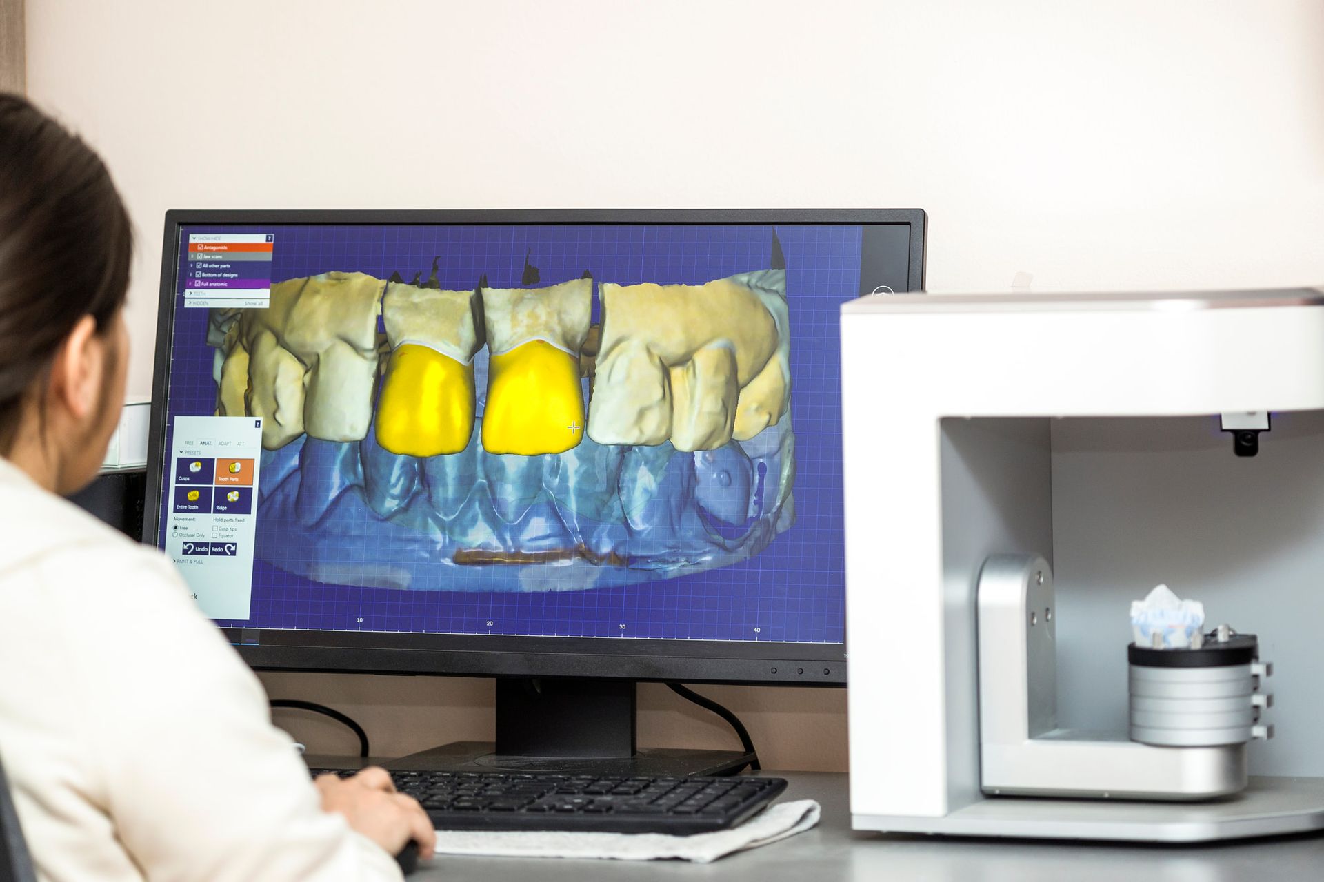 Digital Smile Design