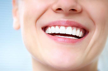Teeth Whitening